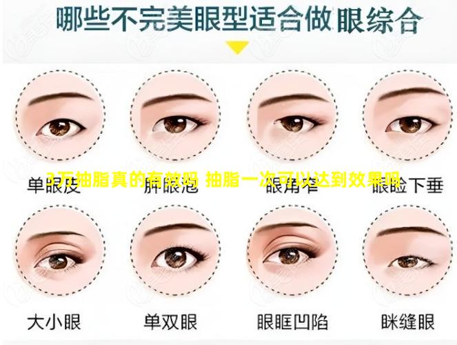 3万抽脂真的有效吗 抽脂一次可以达到效果吗